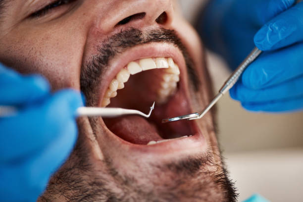 Best Emergency Tooth Extraction in Long View, NC